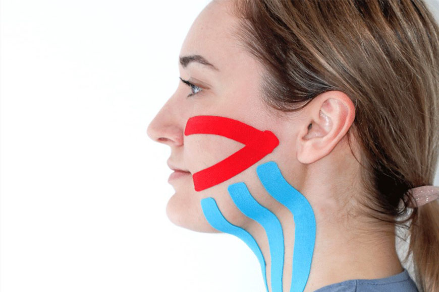 Use of Kinesiology Taping in Dentistry Use of Kinesiology Taping in Dentistry